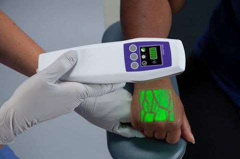 VINTERA Vein Finder