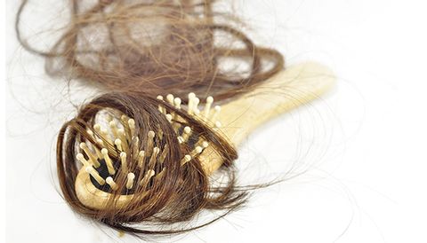 Alopecia Areata Treatment